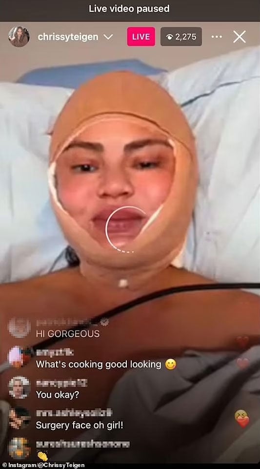 The details of Chrissy Teigens surgery are revealed