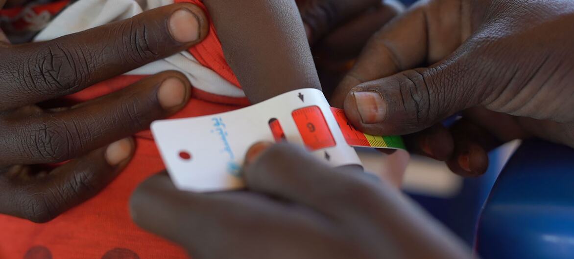 Close-up of hands using a measuring tape to assess a child's arm circumference at a UNICEF-supported nutrition center in Tawila, North Darfur, Sudan, for early detection of malnutrition.