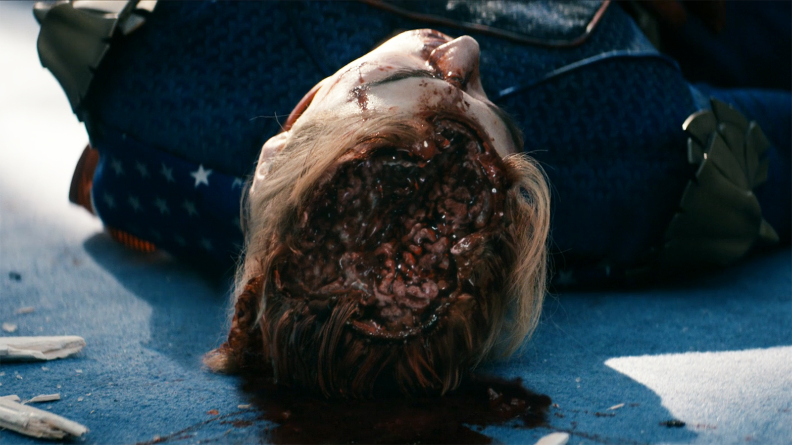 A close-up of Homelander's corpse with his brain exposed in The Boys series finale